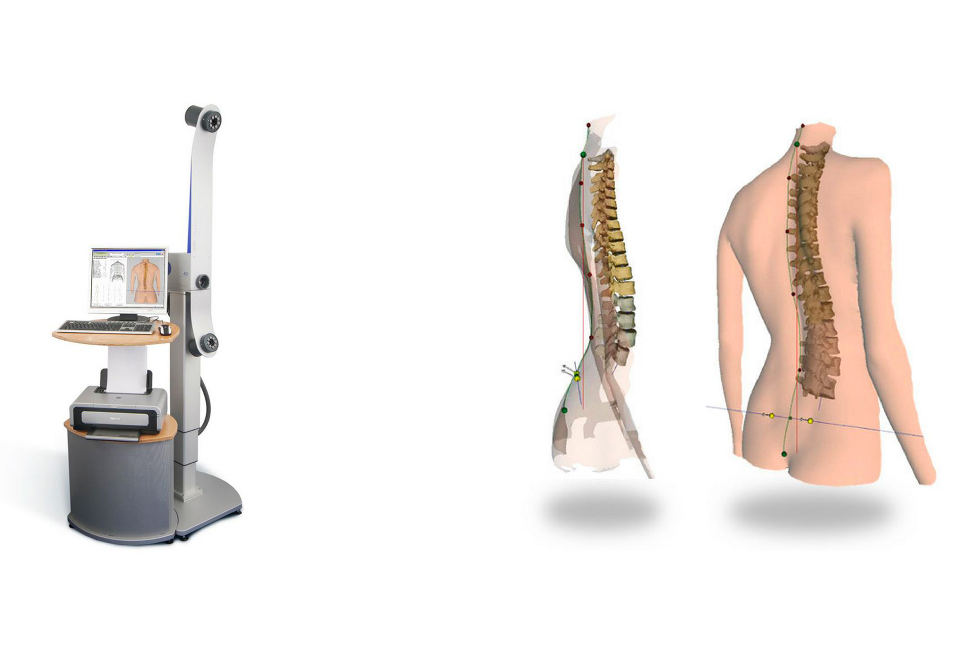 Fisioterapia, osteopatia e ginnastica posturale